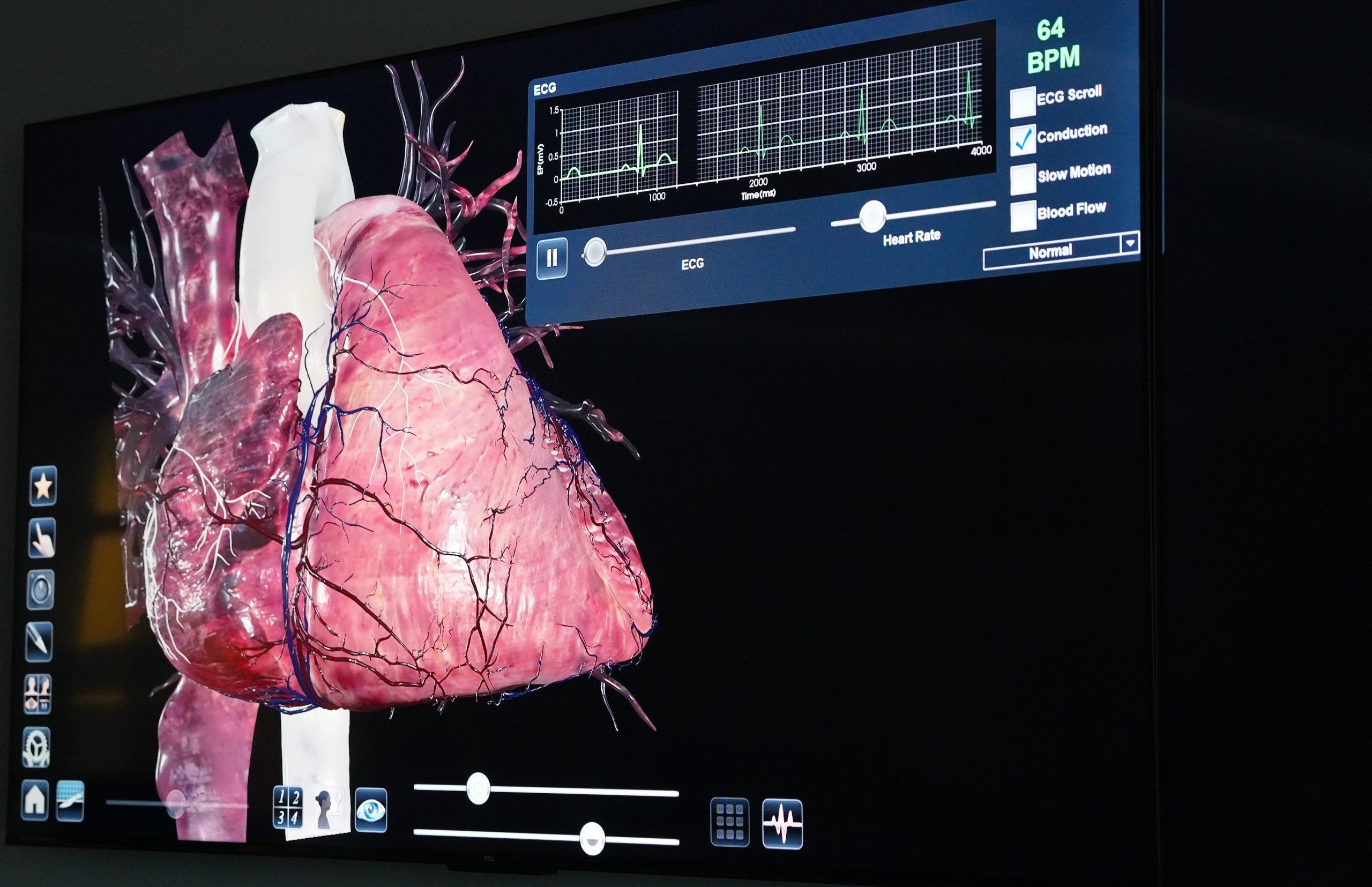 A simulation of a heart is shown on a monitor.
